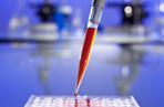 Pipette being used to fill a plate with lots of wells with red liquid